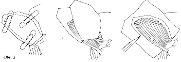 troj obr